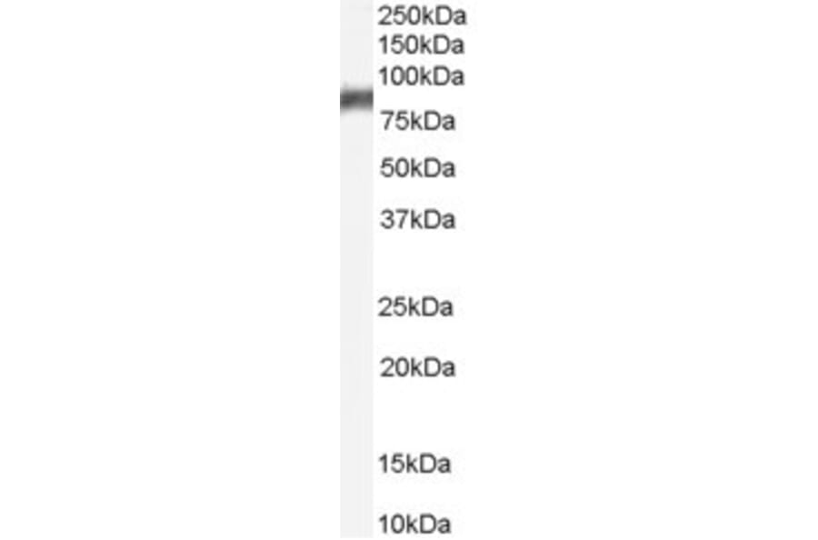 Western Blot - Anti-5 Lipoxygenase/5-LO Antibody (A84239) - Antibodies.com