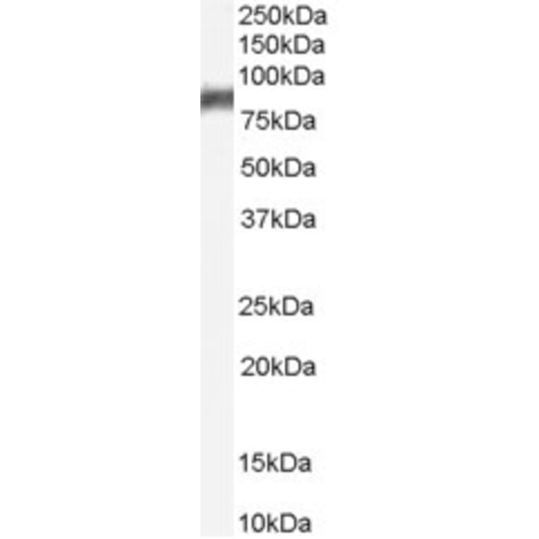 Western Blot - Anti-5 Lipoxygenase/5-LO Antibody (A84239) - Antibodies.com
