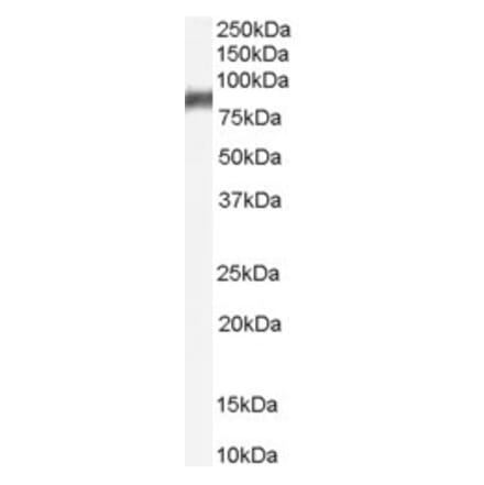 Western Blot - Anti-ALOX5 Antibody (A84239) - Antibodies.com