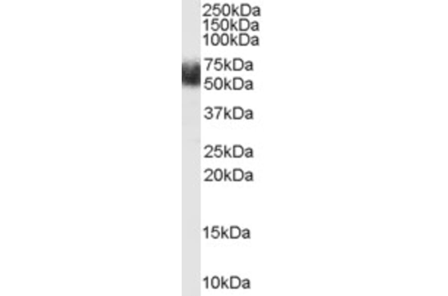 Western Blot - Anti-FBXL3 Antibody (A84241) - Antibodies.com