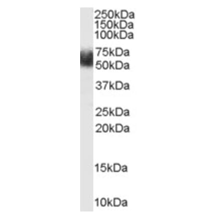 Western Blot - Anti-FBXL3 Antibody (A84241) - Antibodies.com