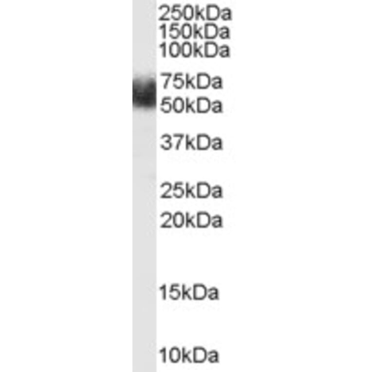 Western Blot - Anti-FBXL3 Antibody (A84241) - Antibodies.com