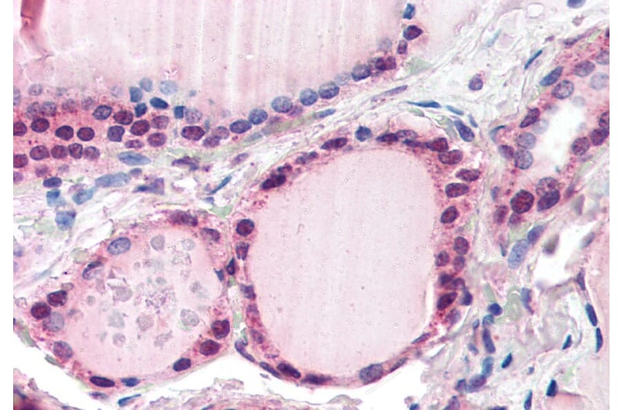 Immunohistochemistry - Anti-FBXL3 Antibody (A84241) - Antibodies.com