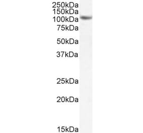 Western Blot - Anti-SIRT1 Antibody (A84243) - Antibodies.com