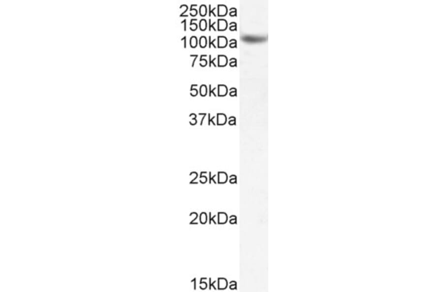 Western Blot - Anti-SIRT1 Antibody (A84243) - Antibodies.com