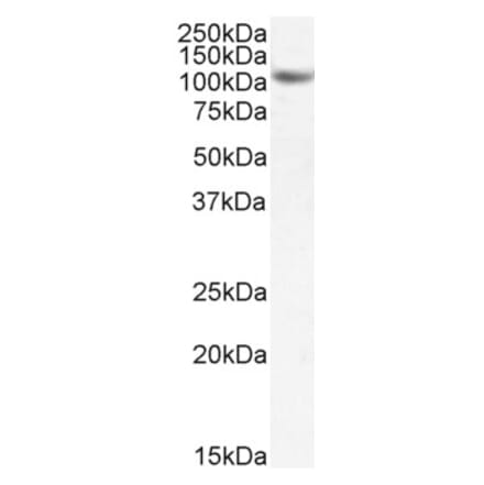 Western Blot - Anti-SIRT1 Antibody (A84243) - Antibodies.com