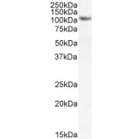 Western Blot - Anti-SIRT1 Antibody (A84243) - Antibodies.com