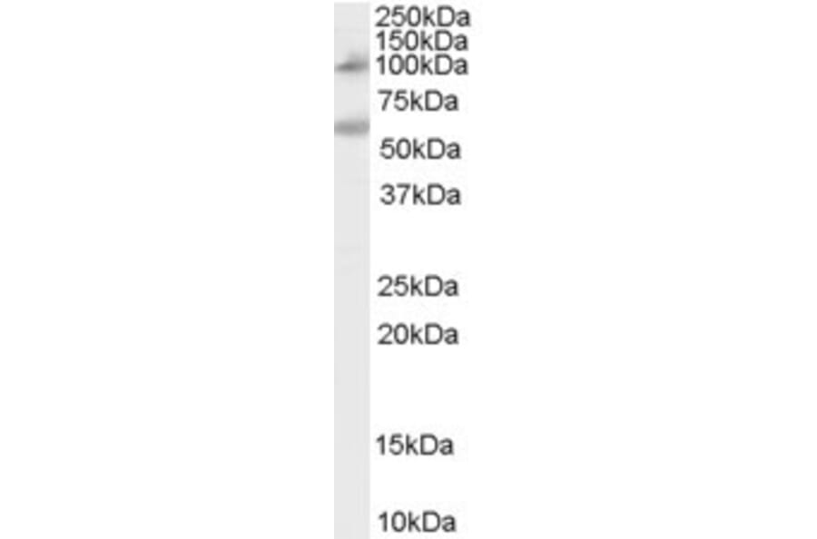 Western Blot - Anti-CARD15/NOD2 Antibody (A84244) - Antibodies.com
