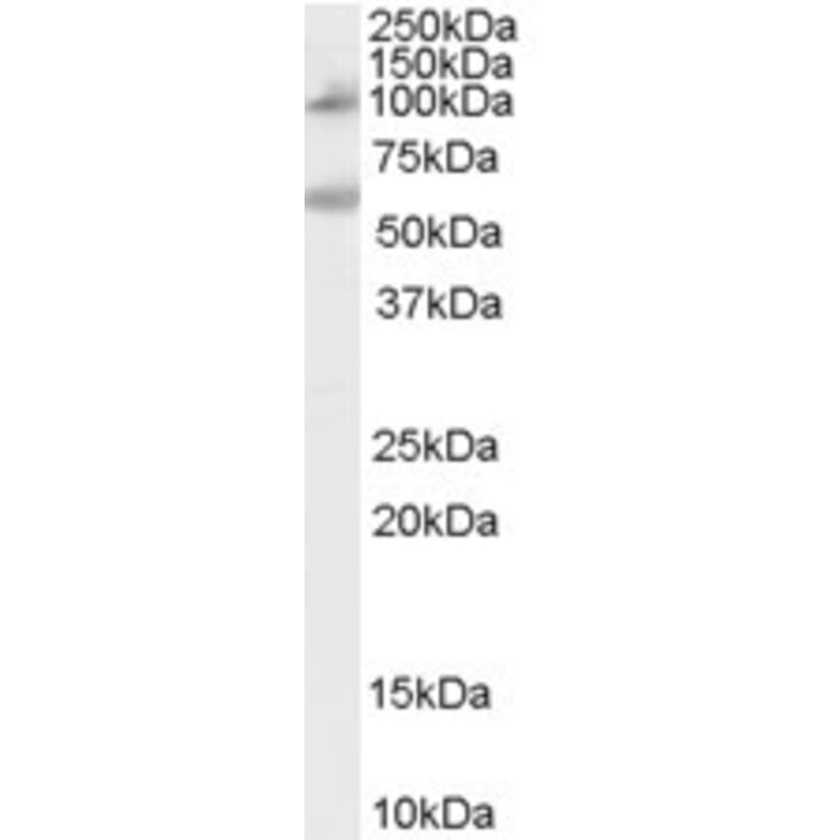 Western Blot - Anti-CARD15/NOD2 Antibody (A84244) - Antibodies.com