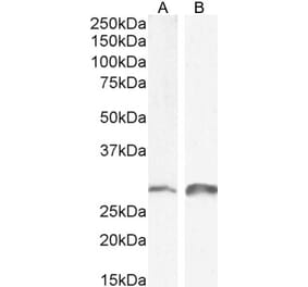 Western Blot - Anti-SNAI1 Antibody (A84245) - Antibodies.com