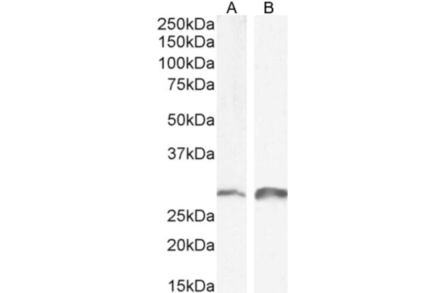 Western Blot - Anti-SNAI1 Antibody (A84245) - Antibodies.com