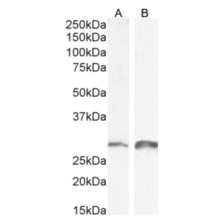 Western Blot - Anti-SNAI1 Antibody (A84245) - Antibodies.com