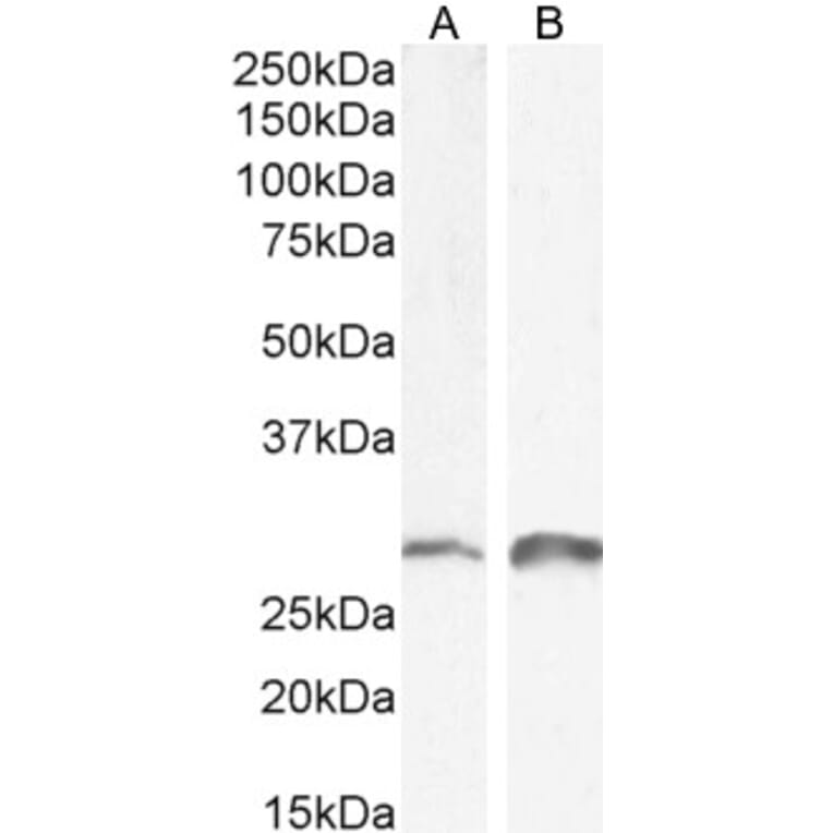 Western Blot - Anti-SNAI1 Antibody (A84245) - Antibodies.com