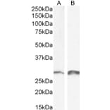 Western Blot - Anti-SNAI1 Antibody (A84245) - Antibodies.com