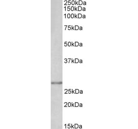 Western Blot - Anti-SNAIL Antibody (A84245)