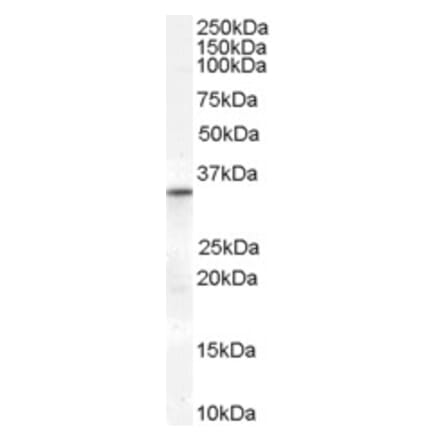 Western Blot - Anti-VDAC2 Antibody (A84247) - Antibodies.com