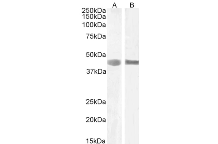 Western Blot - Anti-LARP Antibody (A84248) - Antibodies.com