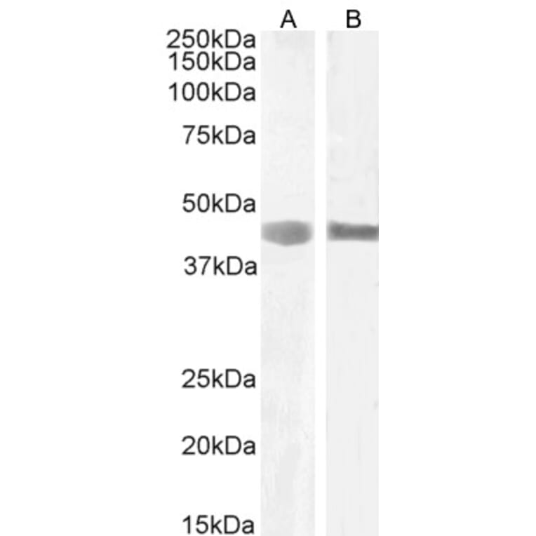 Western Blot - Anti-LARP Antibody (A84248) - Antibodies.com