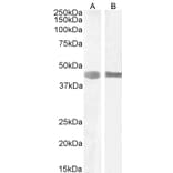 Western Blot - Anti-LARP Antibody (A84248) - Antibodies.com