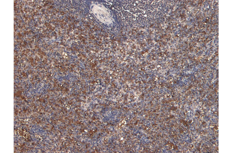 Immunohistochemistry - Anti-LARP Antibody (A84248) - Antibodies.com