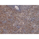 Immunohistochemistry - Anti-LARP Antibody (A84248) - Antibodies.com