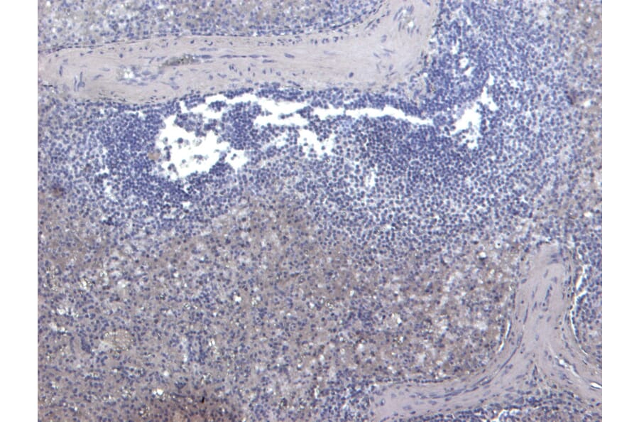 Immunohistochemistry - Anti-LARP Antibody (A84248) - Antibodies.com