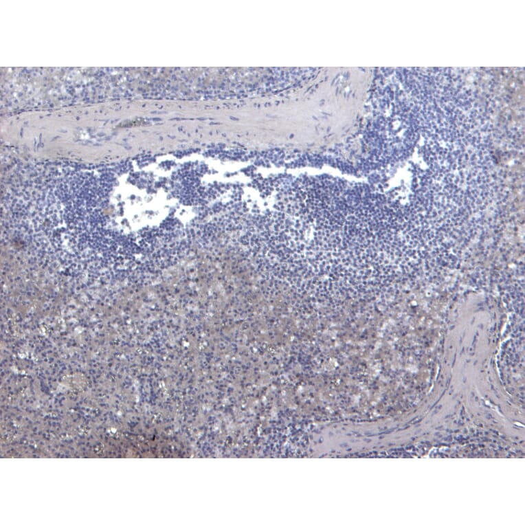Immunohistochemistry - Anti-LARP Antibody (A84248) - Antibodies.com