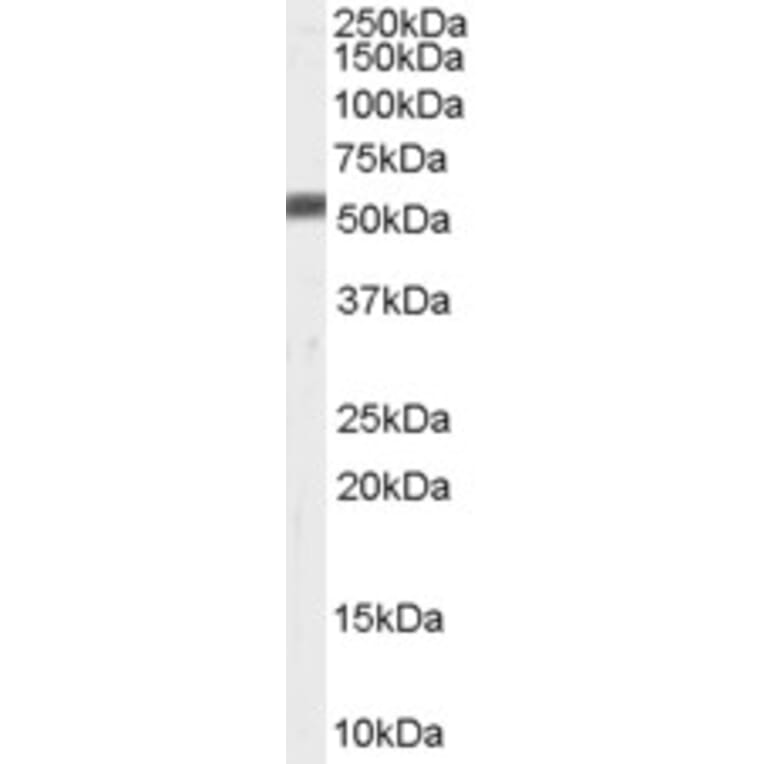 Western Blot - Anti-ZMPSTE24 Antibody (A84249) - Antibodies.com