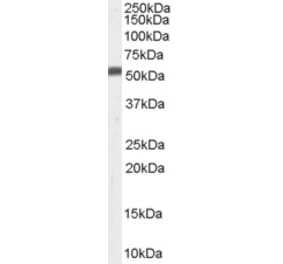 Western Blot - Anti-ZMPSTE24 Antibody (A84249) - Antibodies.com