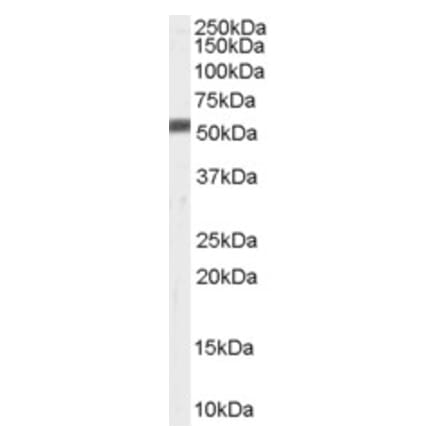 Western Blot - Anti-ZMPSTE24 Antibody (A84249) - Antibodies.com