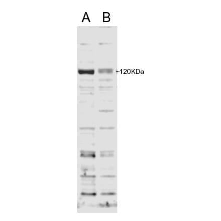 Western Blot - Anti-SECISBP2 Antibody (A84250) - Antibodies.com