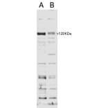 Western Blot - Anti-SECISBP2 Antibody (A84250) - Antibodies.com