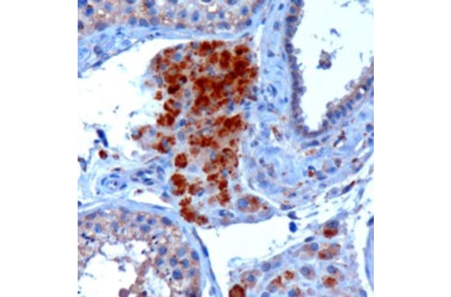 Immunohistochemistry - Anti-SECISBP2 Antibody (A84250) - Antibodies.com