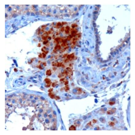 Immunohistochemistry - Anti-SECISBP2 Antibody (A84250) - Antibodies.com