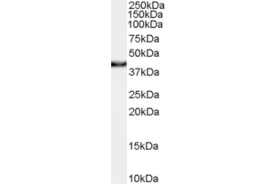 Western Blot - Anti-XLF Antibody (A84252) - Antibodies.com