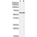 Western Blot - Anti-SMO Antibody (A84253) - Antibodies.com