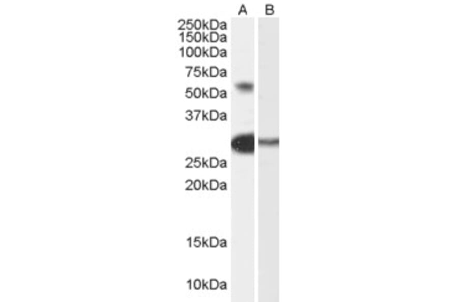 Western Blot - Anti-TCFL5 Antibody (A84254) - Antibodies.com