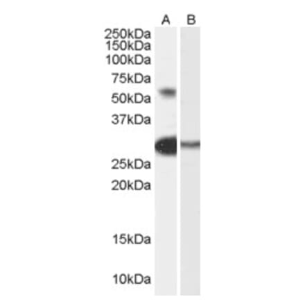 Western Blot - Anti-TCFL5 Antibody (A84254) - Antibodies.com