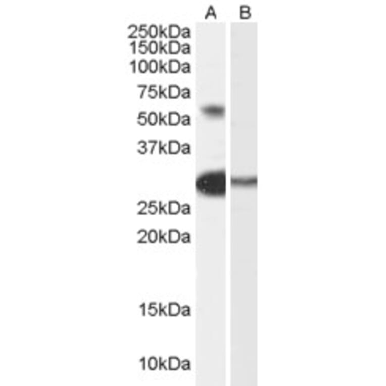 Western Blot - Anti-TCFL5 Antibody (A84254) - Antibodies.com
