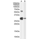 Western Blot - Anti-TCFL5 Antibody (A84254) - Antibodies.com