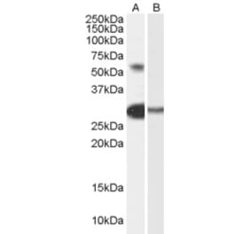 Western Blot - Anti-TCFL5 Antibody (A84254) - Antibodies.com