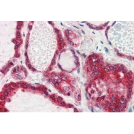 Immunohistochemistry - Anti-Lipin 3 Antibody (A84256) - Antibodies.com