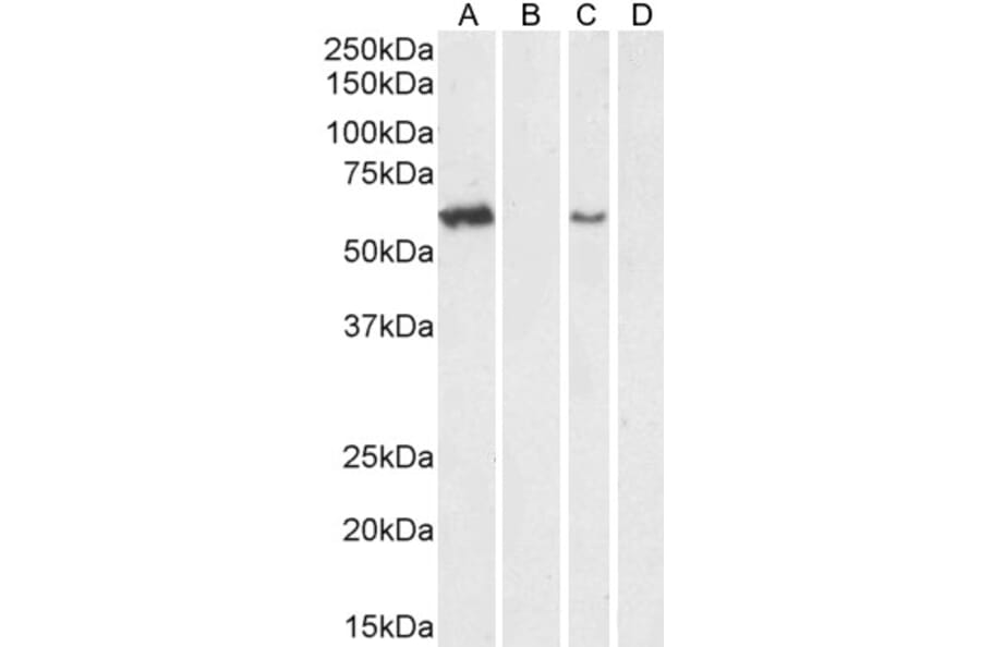 Western Blot - Anti-ARSA/ASA Antibody (A84257) - Antibodies.com