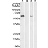 Western Blot - Anti-ARSA/ASA Antibody (A84257) - Antibodies.com