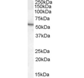 Western Blot - Anti-ARSA Antibody (A84257)