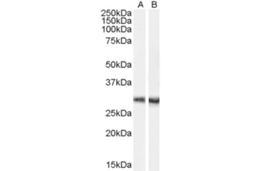 Western Blot - Anti-DCDC2/RU2 Antibody (A84258) - Antibodies.com