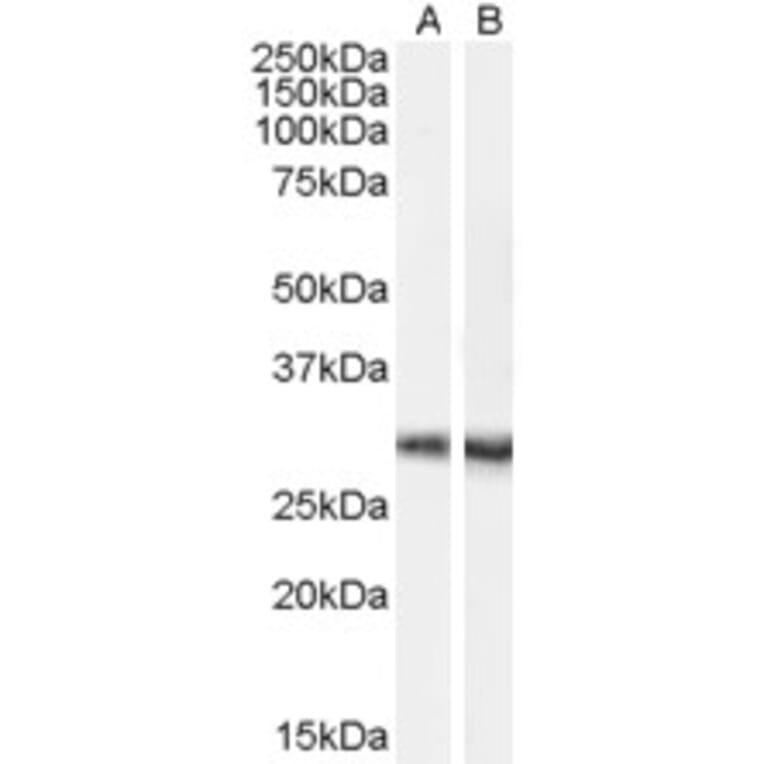 Western Blot - Anti-DCDC2/RU2 Antibody (A84258) - Antibodies.com