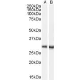 Western Blot - Anti-DCDC2/RU2 Antibody (A84258) - Antibodies.com