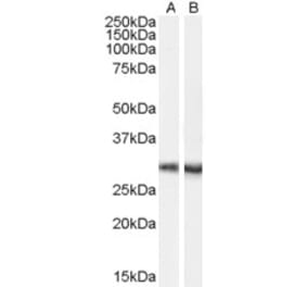 Western Blot - Anti-Dcdc2a Antibody (A84258) - Antibodies.com