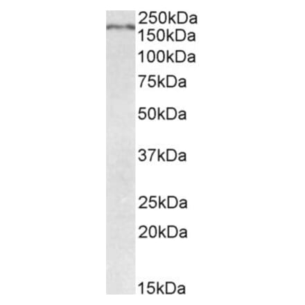 Western Blot - Anti-Robo1 Antibody (A84259) - Antibodies.com